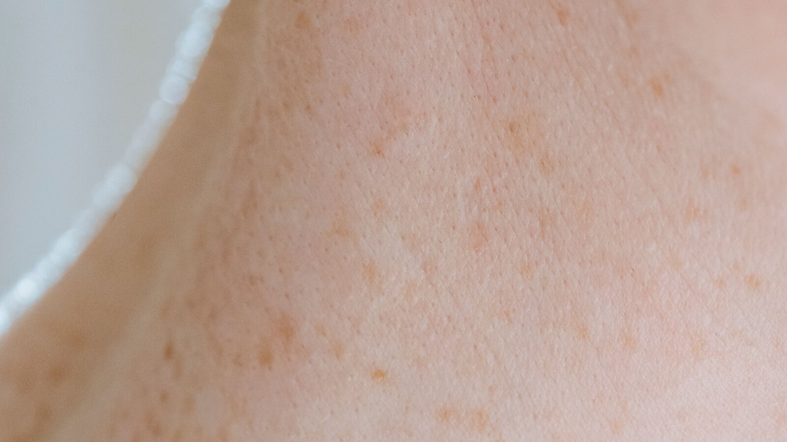 A close view of healthy skin